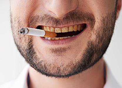 Los dientes y el tabaco