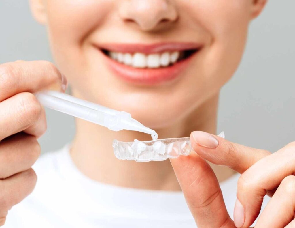 blanqueamiento dental