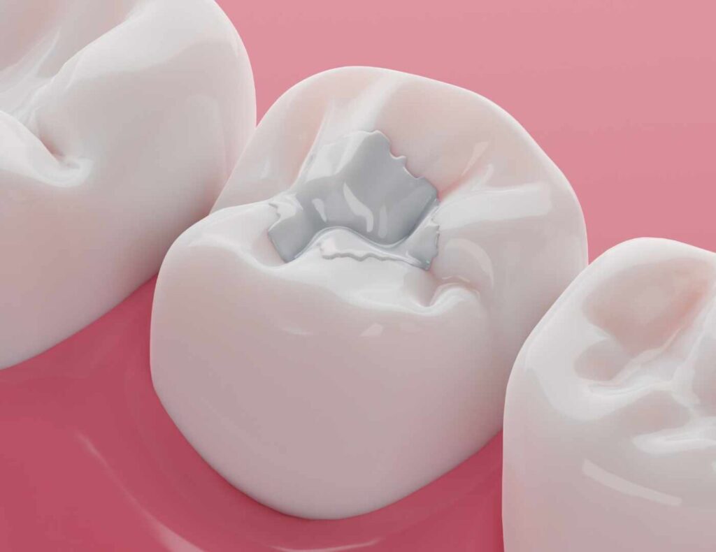 Dentista Odontología conservadora