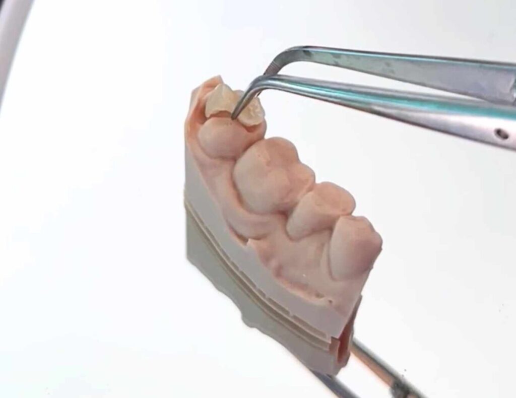 Dentista Odontología conservadora