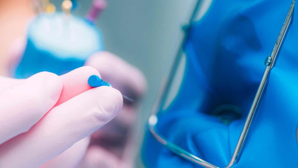 Endodoncia