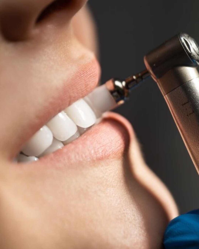 limpieza dental
