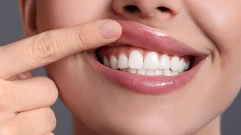 periodoncia encías