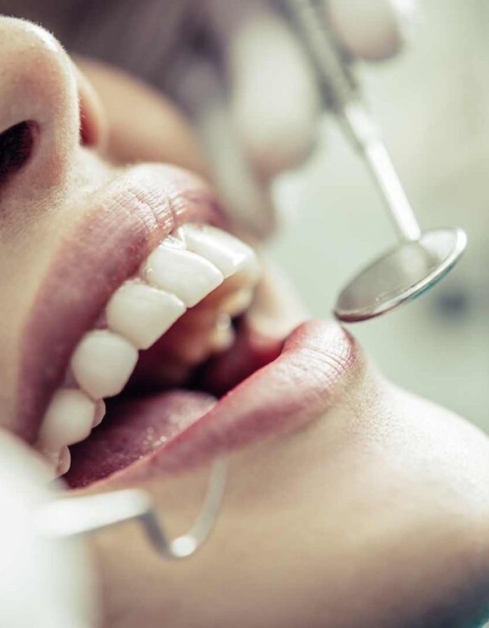 Dentista Odontología conservadora