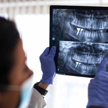 Endodoncia