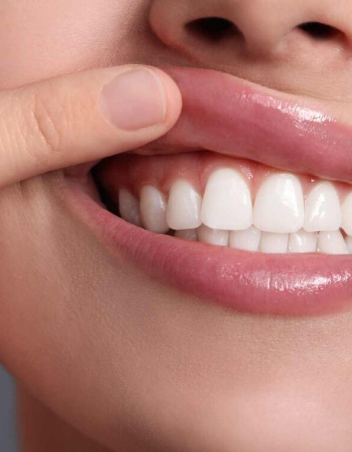 periodoncia encías