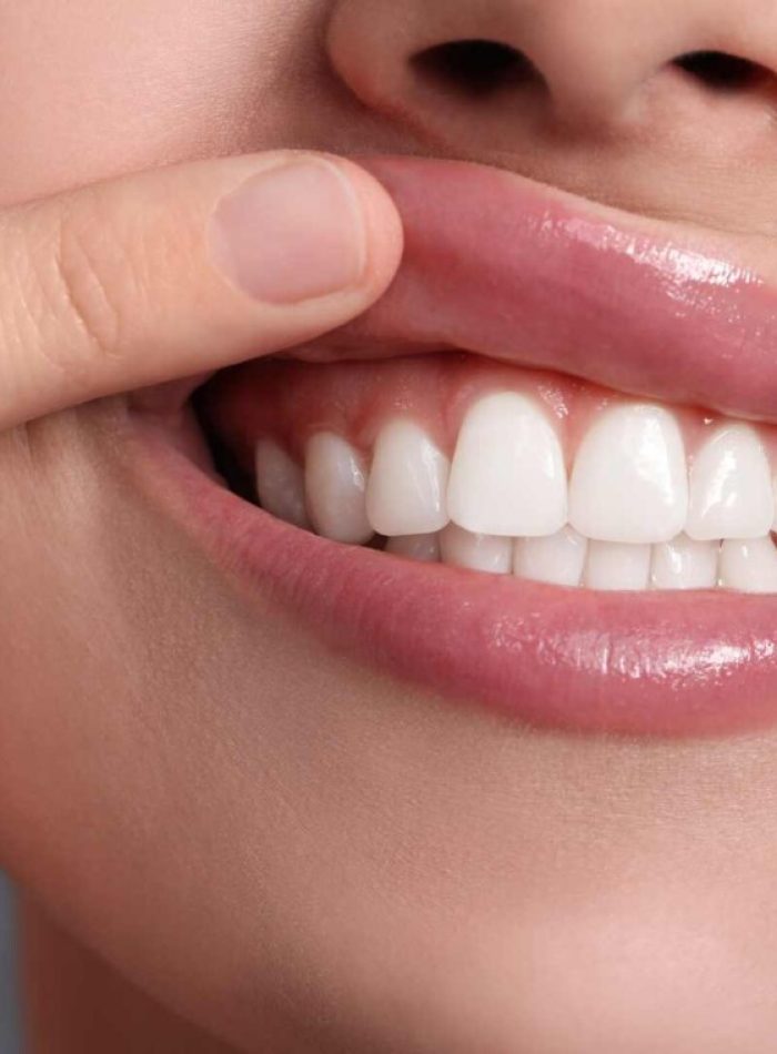 periodoncia encías